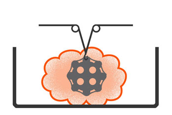 Grafik Folgetechnologie - chemisches Glätten